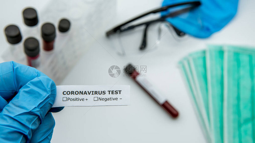 戴蓝色手套的科学家拿着用于COVID19测试的识别标签图片