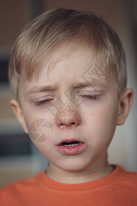 五岁的男孩过敏的鼻图片
