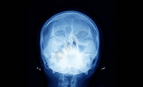 直接投影医疗诊断创伤和矫形神经外科文本空间中头图片