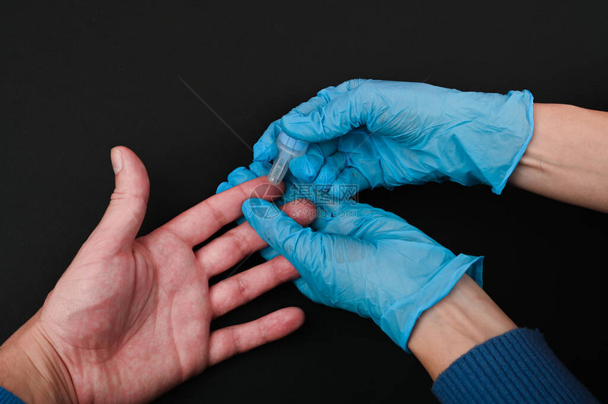 从手指取血进行诊断特写在黑色背景上电晕概念医生对患者进行生化血液检查以图片