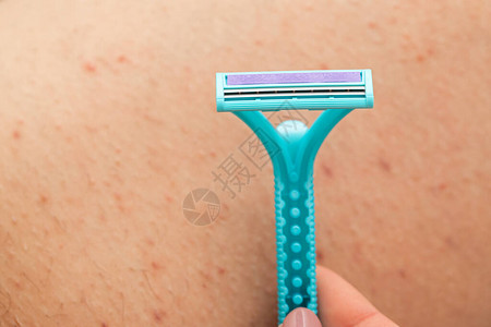 毛囊炎近距离的图片女人拿着剃刀刮毛背景