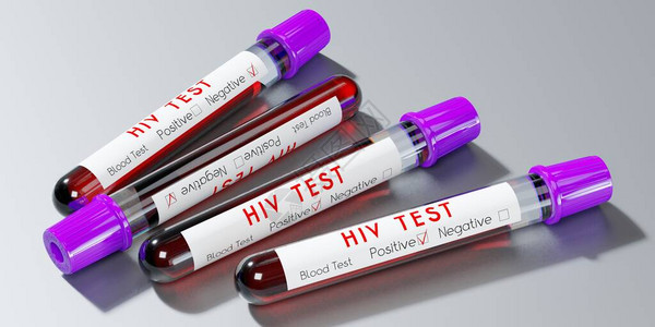 HIV艾滋病试管验血图片