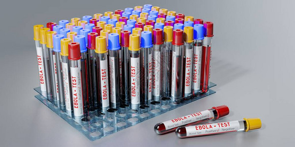 埃博拉试管血液测试图片