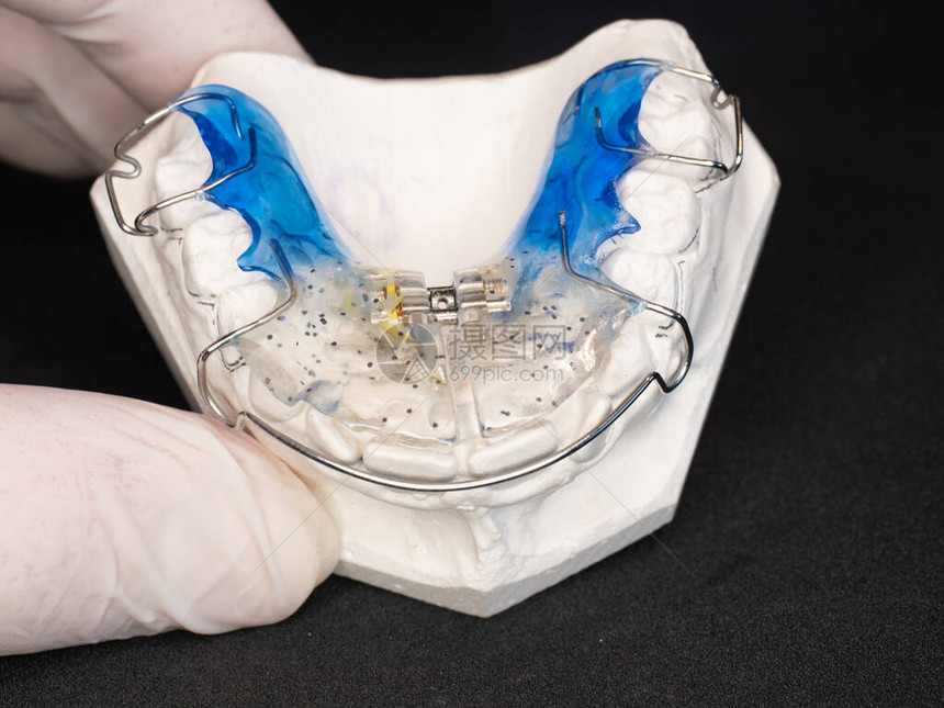 药用手的牙齿矫形器用的可移动蓝牙调制图片
