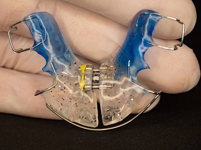 牙医展示用于睡眠的牙科蓝色可拆卸固定器保持器蓝色在手边与图片