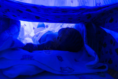 新生婴儿在保温箱中的紫外线下治疗黄疸图片