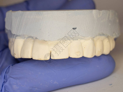 牙膏齿模型牙医实验室病人的药剂图片