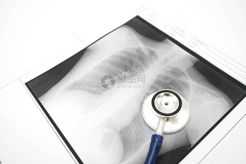 肺X光检查Covid19或冠状使用作为背景的医疗保健概念和具有复制空图片