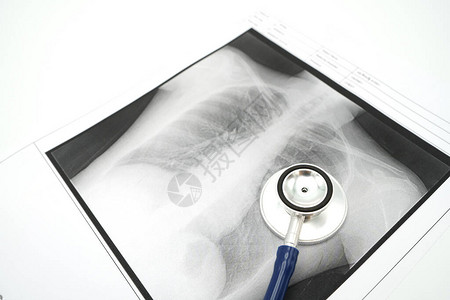 肺X光检查Covid19或冠状使用作为背景的医疗保健概念和具有复制空图片