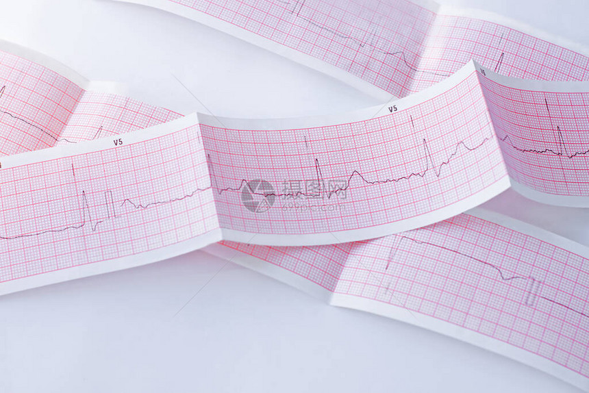年轻人的心电图图片