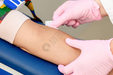 护士在医疗中心注射疫苗之前先用其手对臂图片