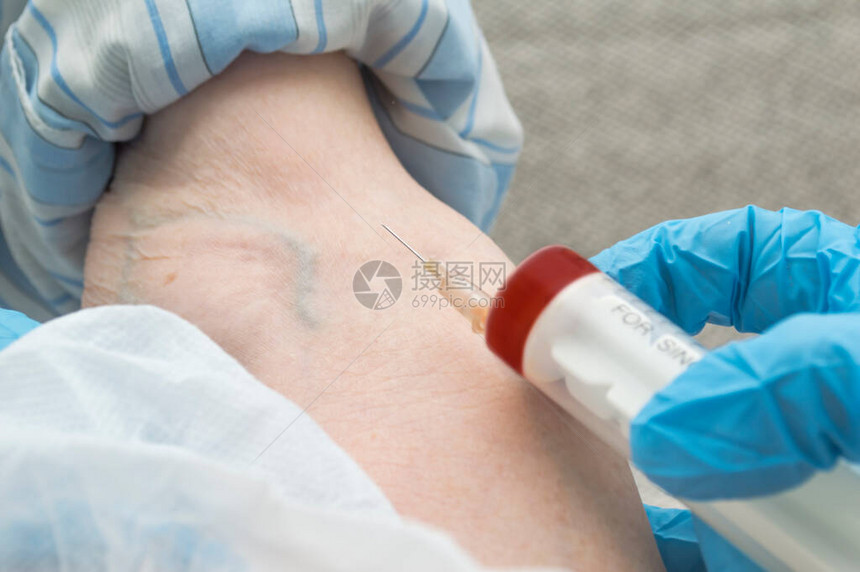 医务人员从一名可能受感染的老年妇女身上提取血液图片