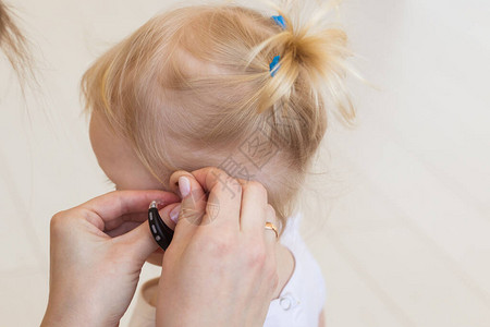 女婴耳朵中的助听器蹒跚学步的孩子在家里戴助听器残疾儿童图片