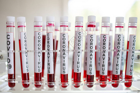 关于Covid19疫苗的近距离报道实验室用血液和在科学图片