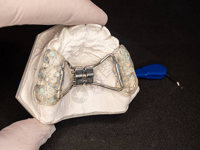 便式冲牙器带有正畸可拆卸扩张器保持器的颌骨石膏模型背景