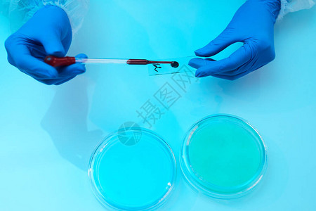 科学家在医疗实验室复制空间检查血样本的上述背景情图片
