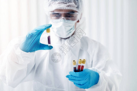 研究人员在实验室测试血样图片