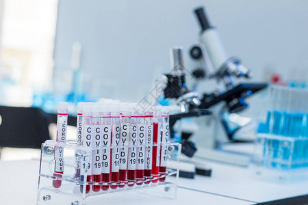 在实验室根据科学实验室的背景进行疫苗研究的Covid19血管近图片