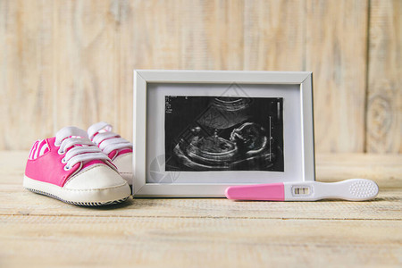 婴儿的照片和配件的超音速照片有选择图片