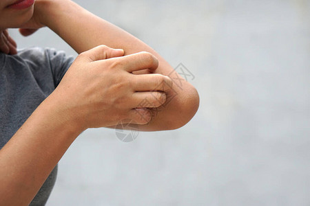 女人在浅灰色的背景上因瘙痒而抓挠手臂皮肤发痒的原因包括昆虫叮咬皮炎食物药物过敏或皮肤干燥保背景图片