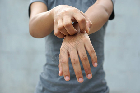 女人在浅灰色的背景上因瘙痒而抓挠手臂皮肤发痒的原因包括昆虫叮咬皮炎药物过敏或皮肤干燥保背景图片