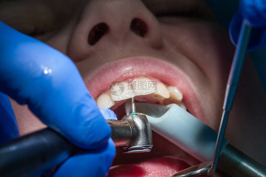 牙医预约的男孩检查孩子的嘴和牙图片