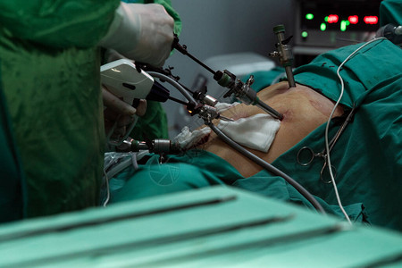外科医生拿着仪器在病人的腹部外科医生在手术室做腹腔镜手背景图片