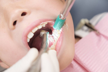 乳牙恒牙正在接受牙医治疗的日本儿童背景