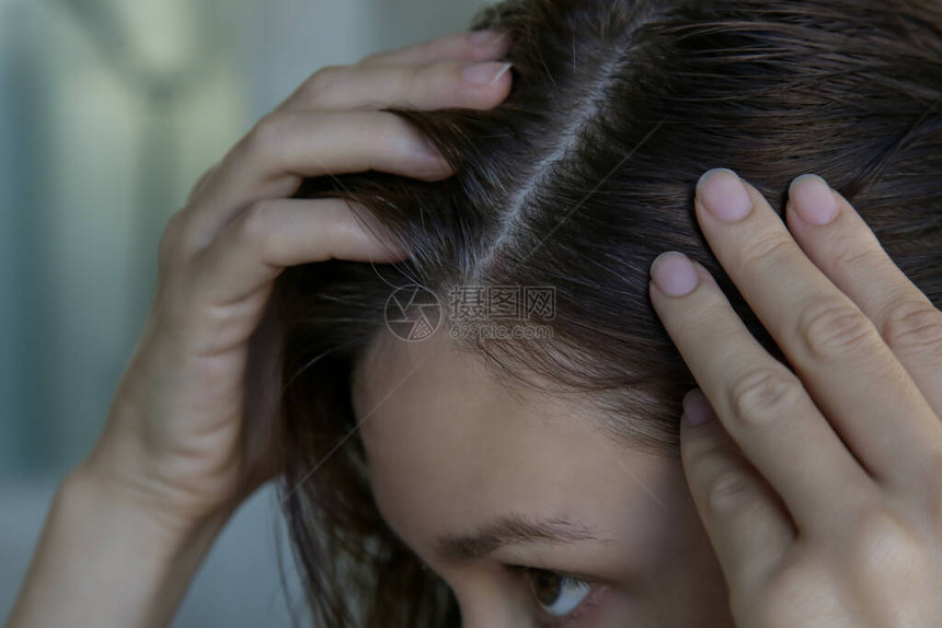 一位漂亮年轻女子在前检查头皮和头发根颜色白发脱发或头皮干图片