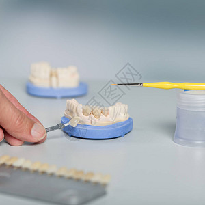用sha检查牙冠或植入物的单板图片