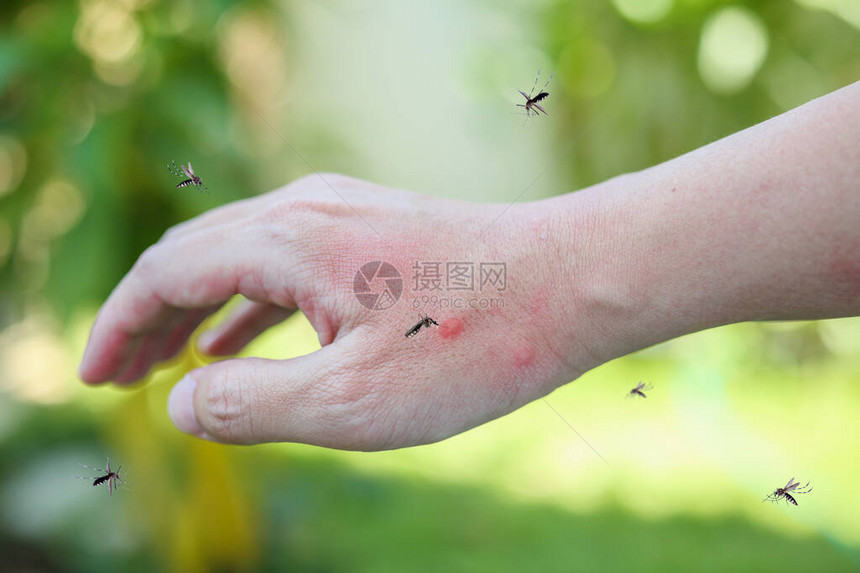 成人手被蚊子咬皮肤图片