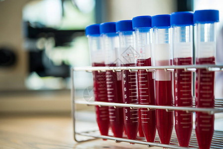 实验室在实验室的试管中分析血液样本医疗制药和图片