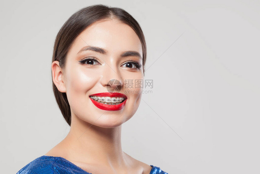 白牙上有牙套的女子穿白色背面笑图片