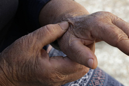 患有手痛的老年妇女关节炎症状图片