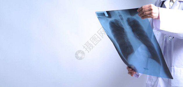 肺癌临床观察亚洲女医生持有和检查科罗纳大流行的肺X光片或射电图背景