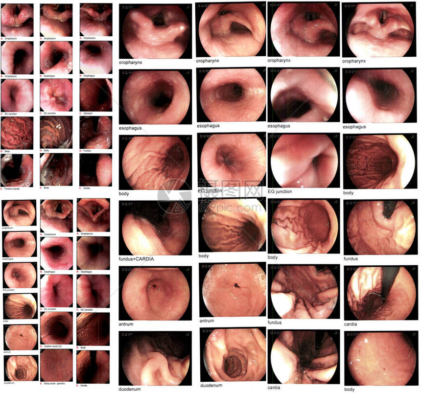 采集胃肠内分泌检查图像图片