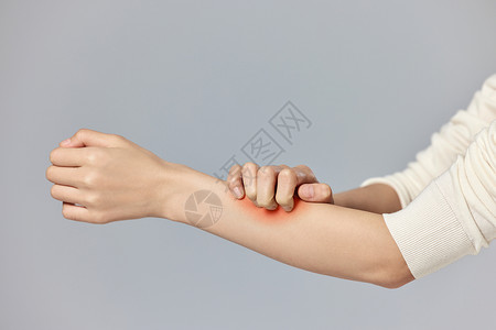 皮肤分析手臂过敏瘙痒抓挠的女性特写背景