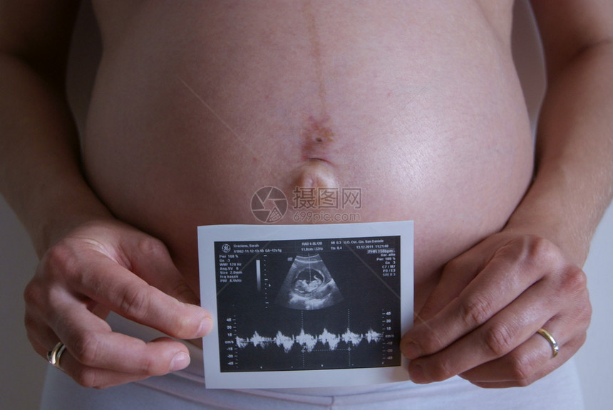 手里拿着超声波的孕妇图片