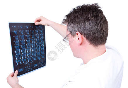 医生分析磁共振图像图片