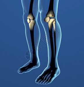 男X射线膝盖图片