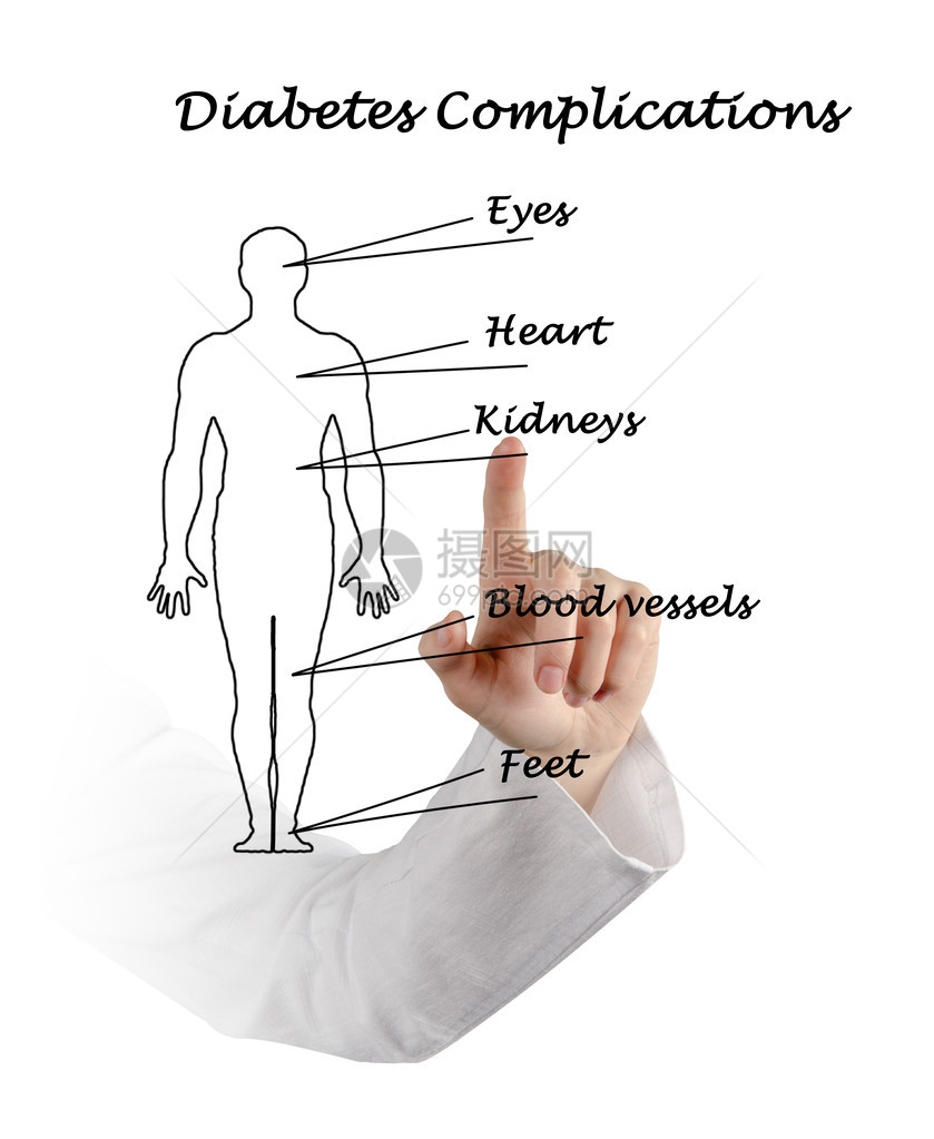 糖尿病并发症图片