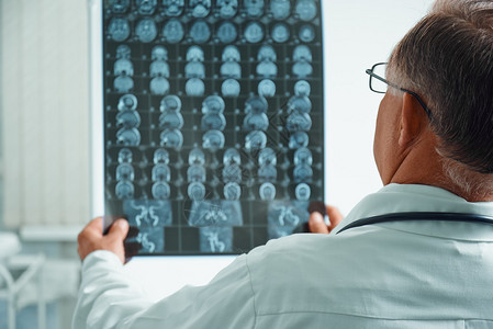 医生检查医院内人体头部MRI图像的医学研究图片