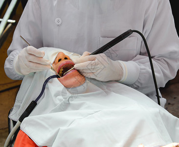 医生用超声波工具给病人洗牙图片