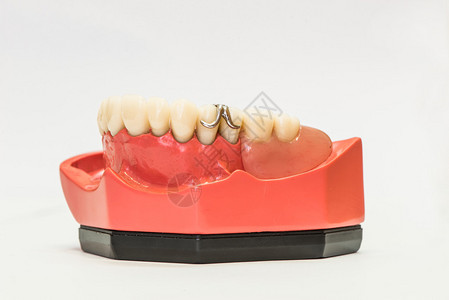 牙科幻影白色背景上孤立的假牙图片