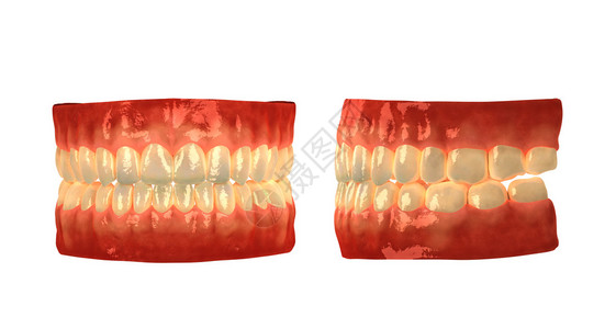 白色背景上孤立的假牙背景图片