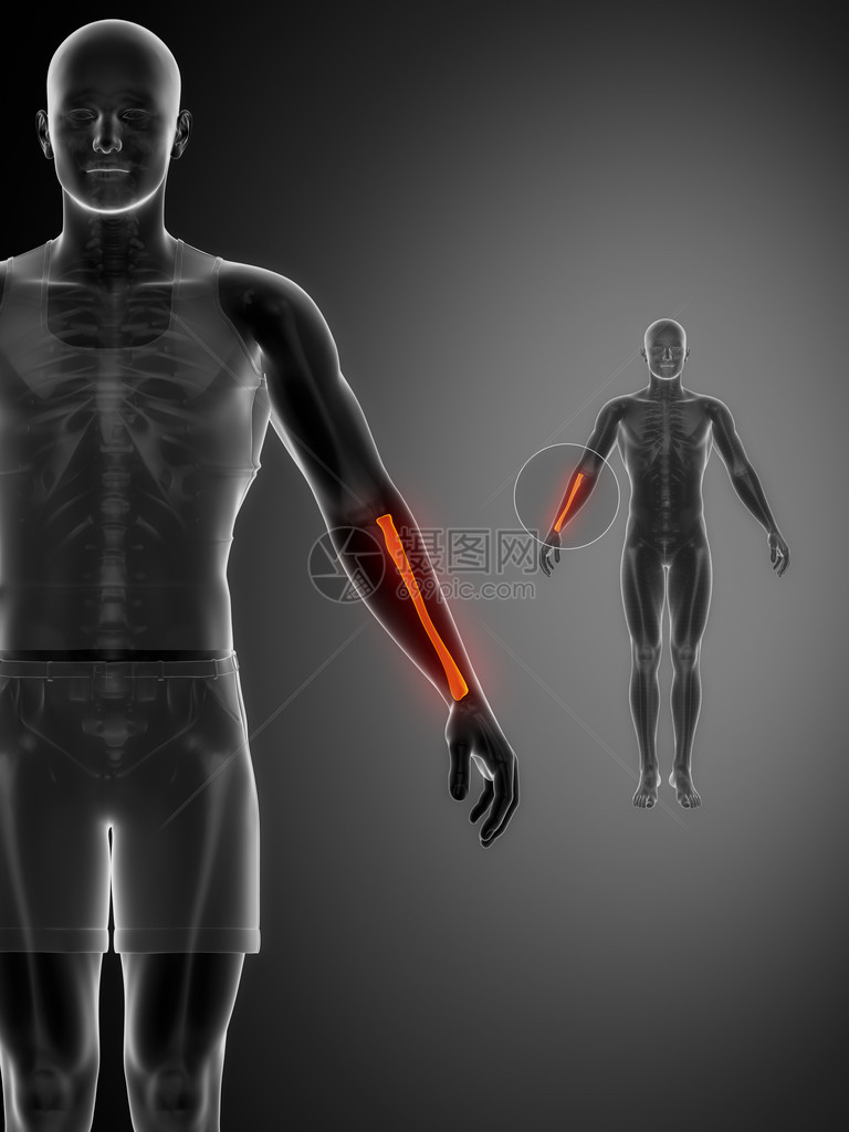 RADIUS黑色X射线骨图片