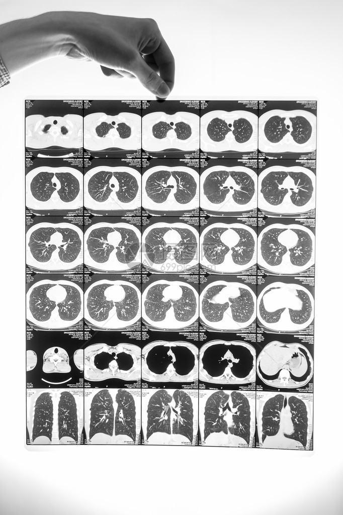 黑色和白色近身镜头男子拿着带肺透图片