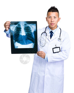 穿白大褂的亚洲男医生带X光片图片