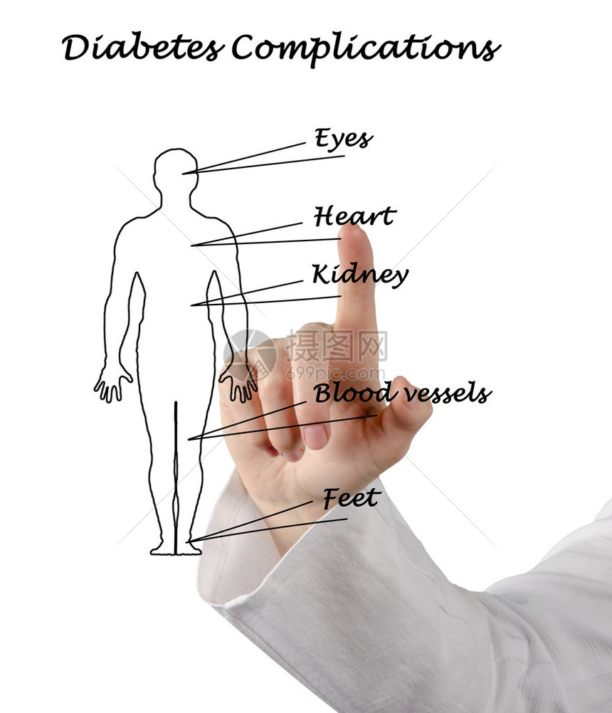 糖尿病并发症图片