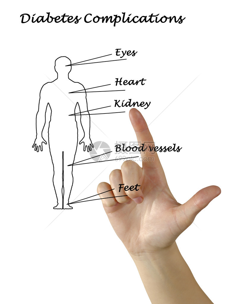 糖尿病并发症图片